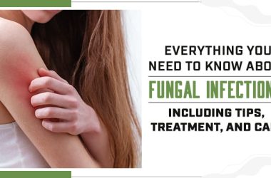 Understanding Fungal Infections: Causes, Symptoms, and Treatment