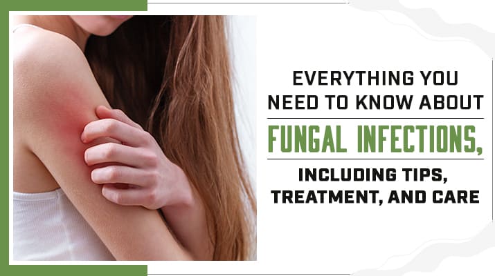 Understanding Fungal Infections: Causes, Symptoms, and Treatment